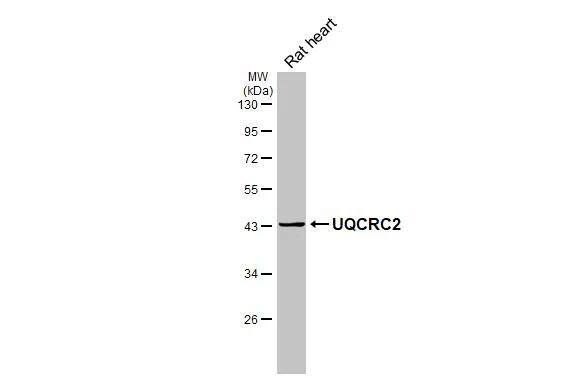 UQCRC2 Antibody (HL3638)