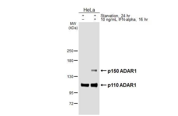 ADAR Antibody (HL3666)