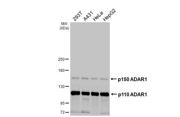 ADAR Antibody (HL3666)