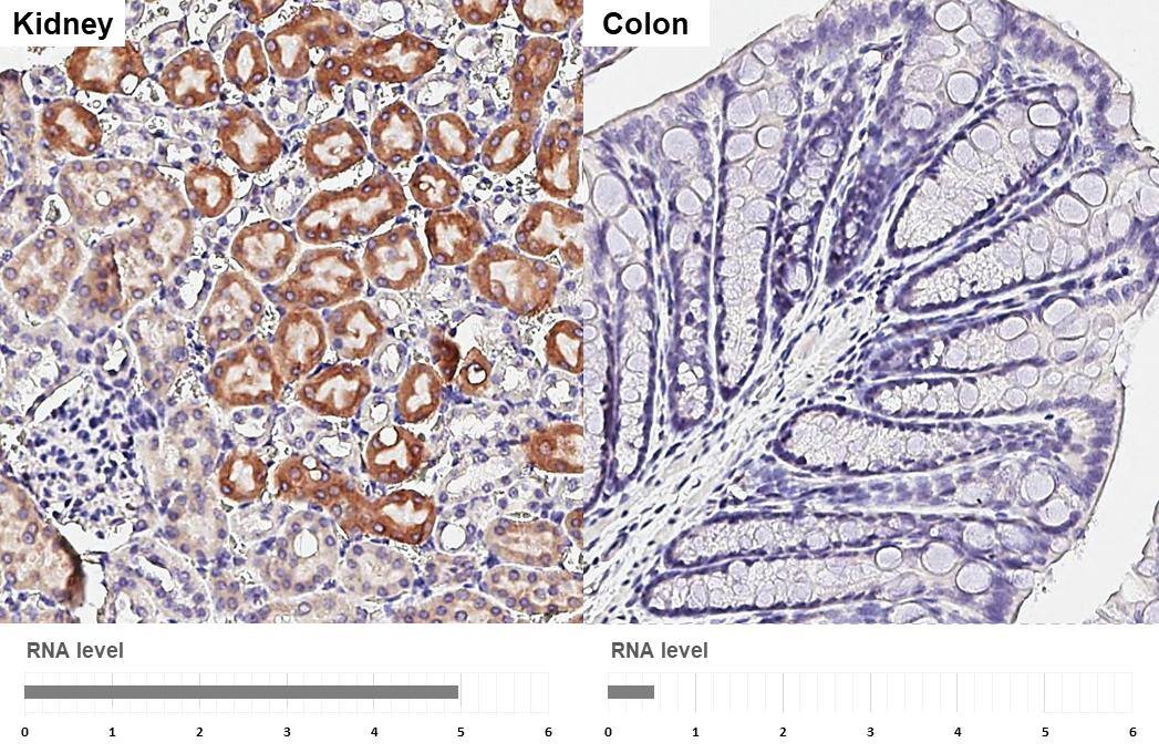 ORP8 Antibody (HL3673)