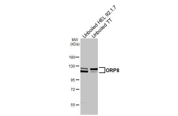 ORP8 Antibody (HL3673)