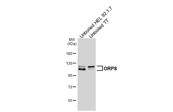 ORP8 Antibody (HL3674)