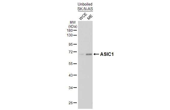 ACCN2 Antibody (GT73)