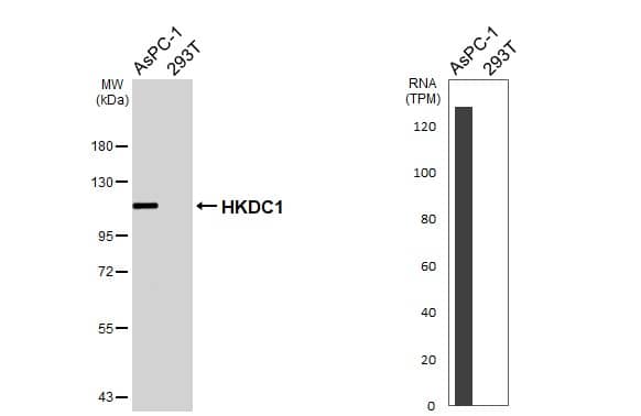 HKDC1 Antibody (HL3743)