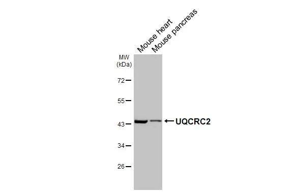 UQCRC2 Antibody (HL3749)