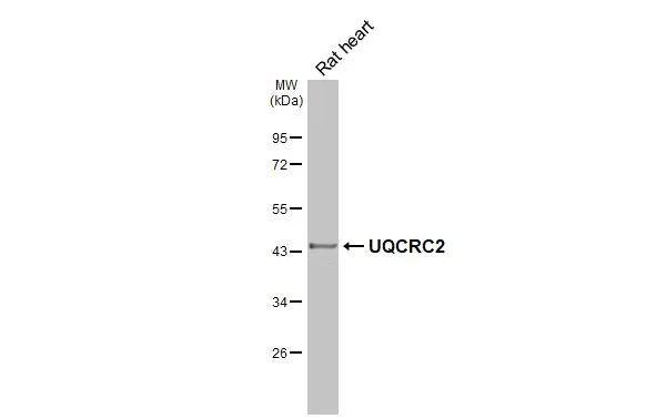 UQCRC2 Antibody (HL3749)
