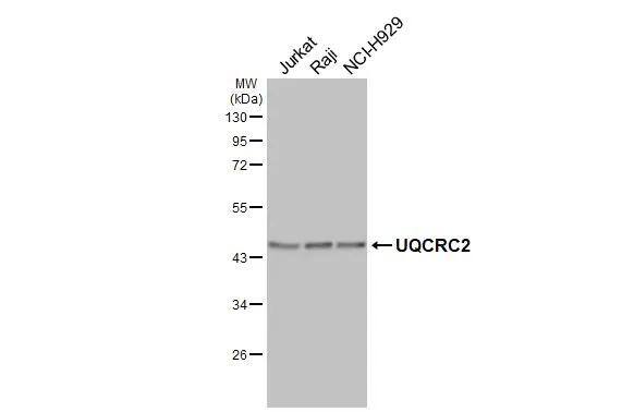 UQCRC2 Antibody (HL3749)