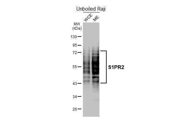 S1P2/EDG-5/S1PR2 Antibody (HL3765)