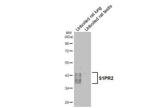 S1P2/EDG-5/S1PR2 Antibody (HL3765)
