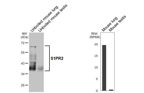 S1P2/EDG-5/S1PR2 Antibody (HL3765)