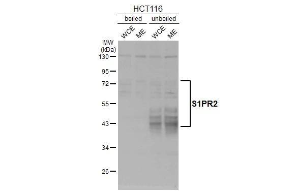 S1P2/EDG-5/S1PR2 Antibody (HL3765)
