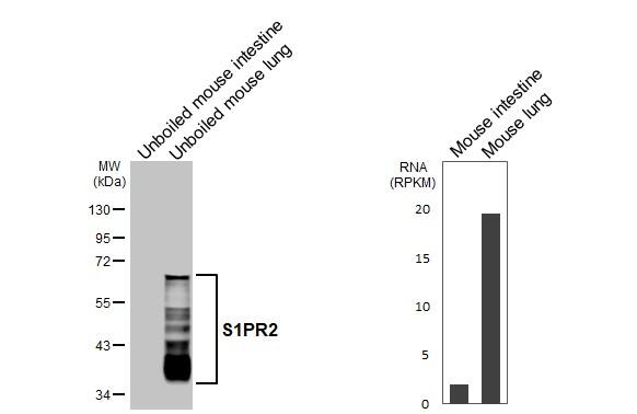 S1P2/EDG-5/S1PR2 Antibody (HL3765)