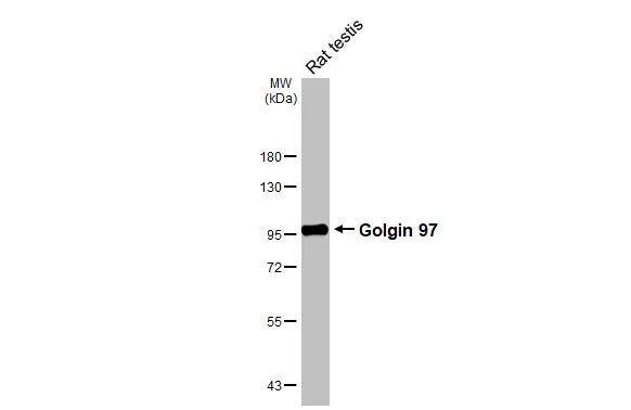 Golgin 97 Antibody (HL3788)