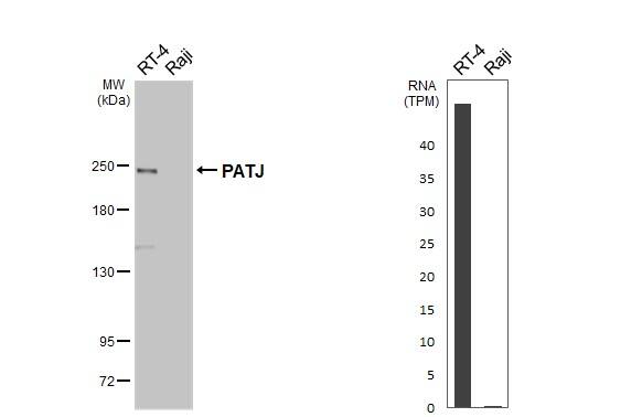 PATJ Antibody (HL3842)