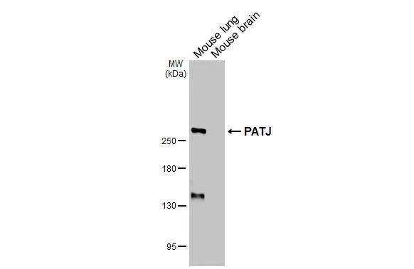 PATJ Antibody (HL3842)