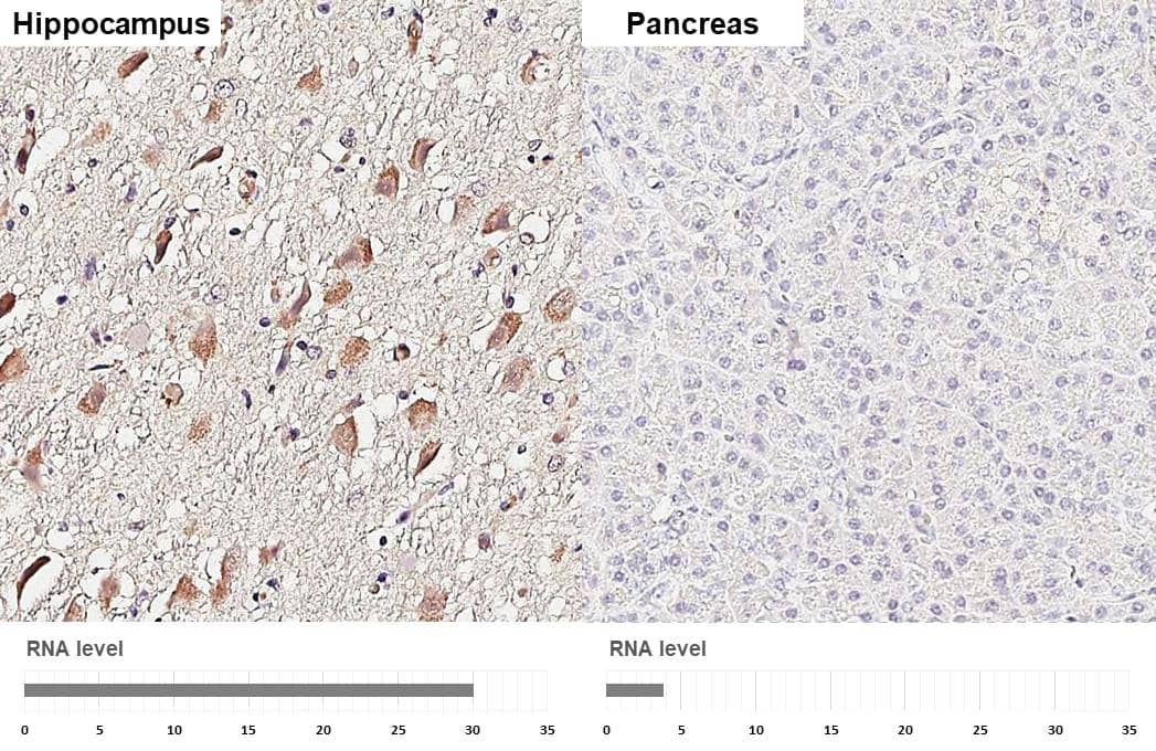 5-HT1E Antibody (HL3875)
