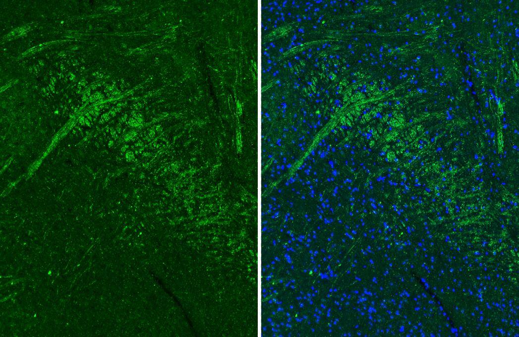 Muscarinic Acetylcholine Receptor M1/CHRM1 Antibody (HL3933)