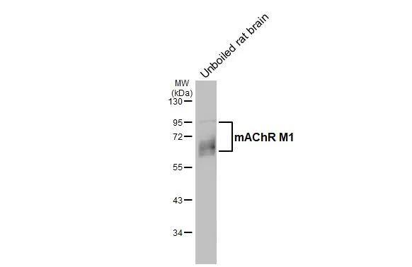 Muscarinic Acetylcholine Receptor M1/CHRM1 Antibody (HL3933)