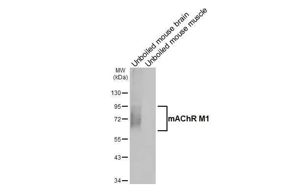 Muscarinic Acetylcholine Receptor M1/CHRM1 Antibody (HL3933)