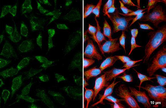 ATPG Antibody (HL3949)