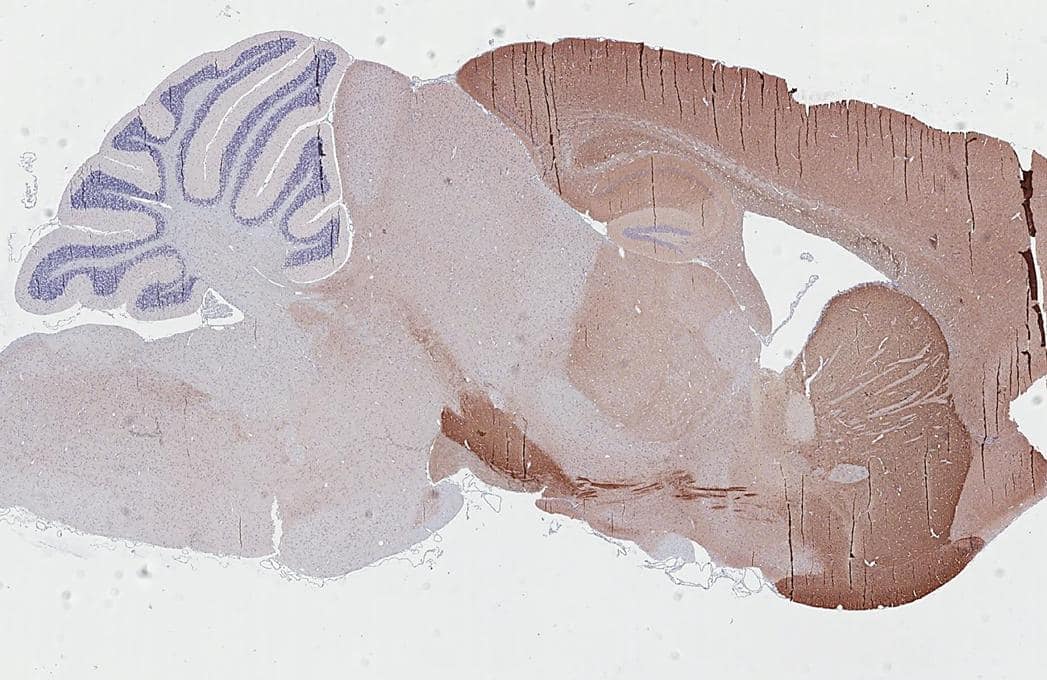 PHACTR1 Antibody (HL3954)