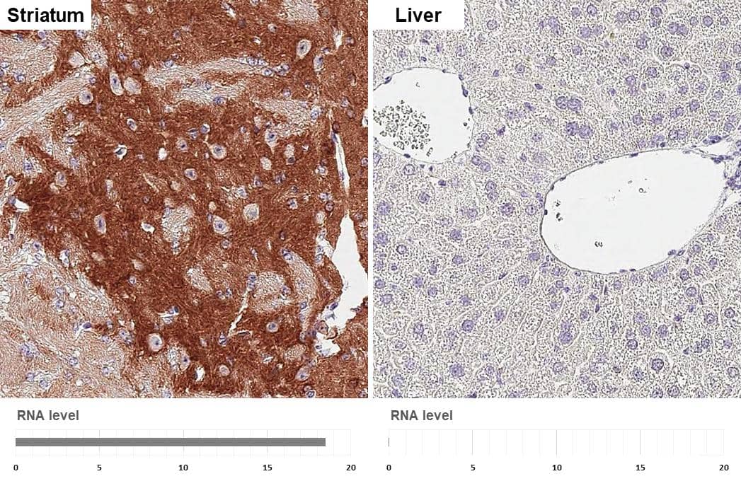 PHACTR1 Antibody (HL3954)