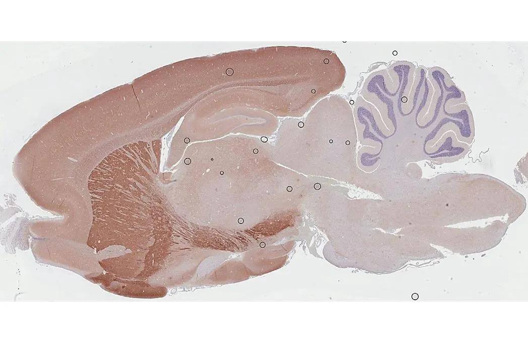 PHACTR1 Antibody (HL3954)