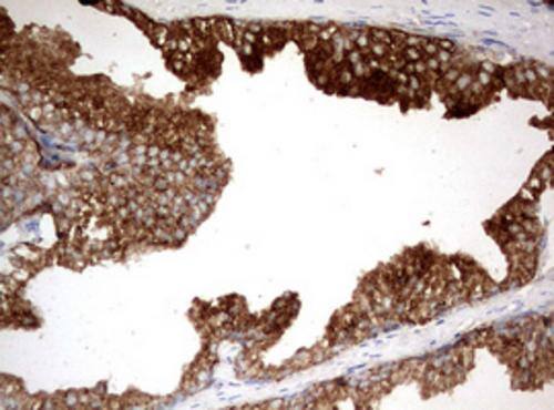 Kallikrein 2 Antibody (OTI5D6) - Azide and BSA Free Immunohistochemistry;Kallikrein 2 Antibody (OTI5D6) - Azide and BSA Free[NBP3-48894]-