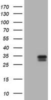 Kallikrein 2 Antibody (OTI5D6) - Azide and BSA Free Western Blot;Kallikrein 2 Antibody (OTI5D6) - Azide and BSA Free[NBP3-48894]-