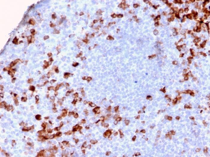 Kappa Light Chain Antibody (KLC2886R)
