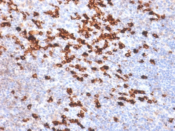 Kappa Light Chain Antibody (IGKC/1999R)