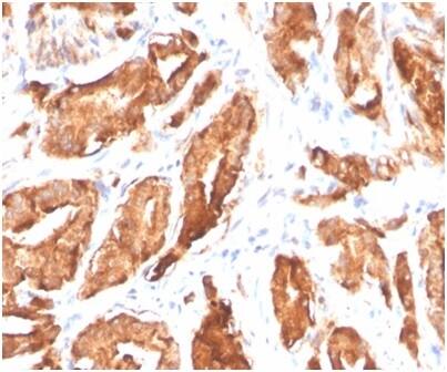 Kallikrein 3/PSA Antibody (KLK3/4602R)