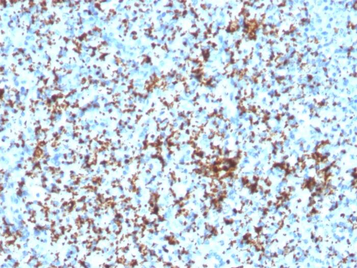 Integrin beta 3/CD61 Antibody (ITGB3/3126R)