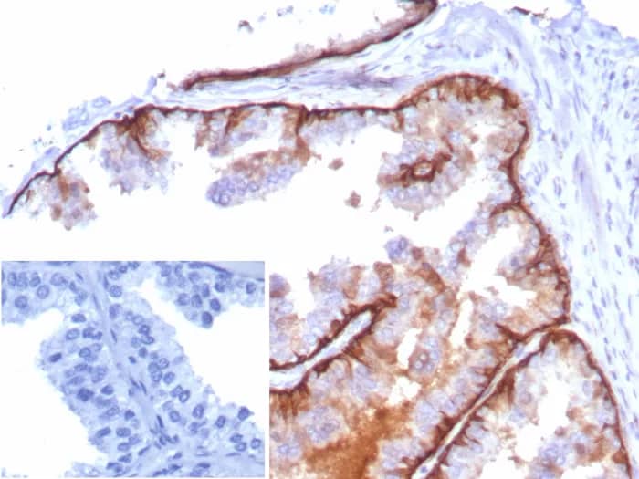 Cytokeratin 5 Antibody (KRT5/8814R)