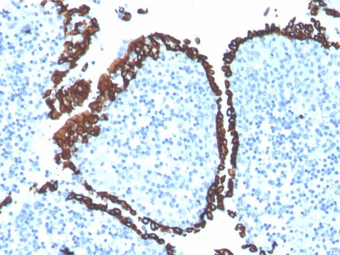 Cytokeratin 5 Antibody (KRT5/4245R)