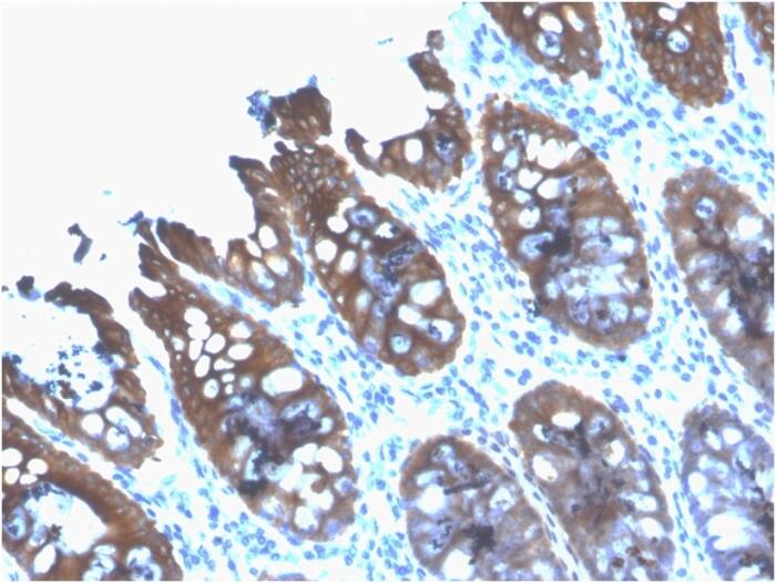 Cytokeratin 8 Antibody (rB22.1)