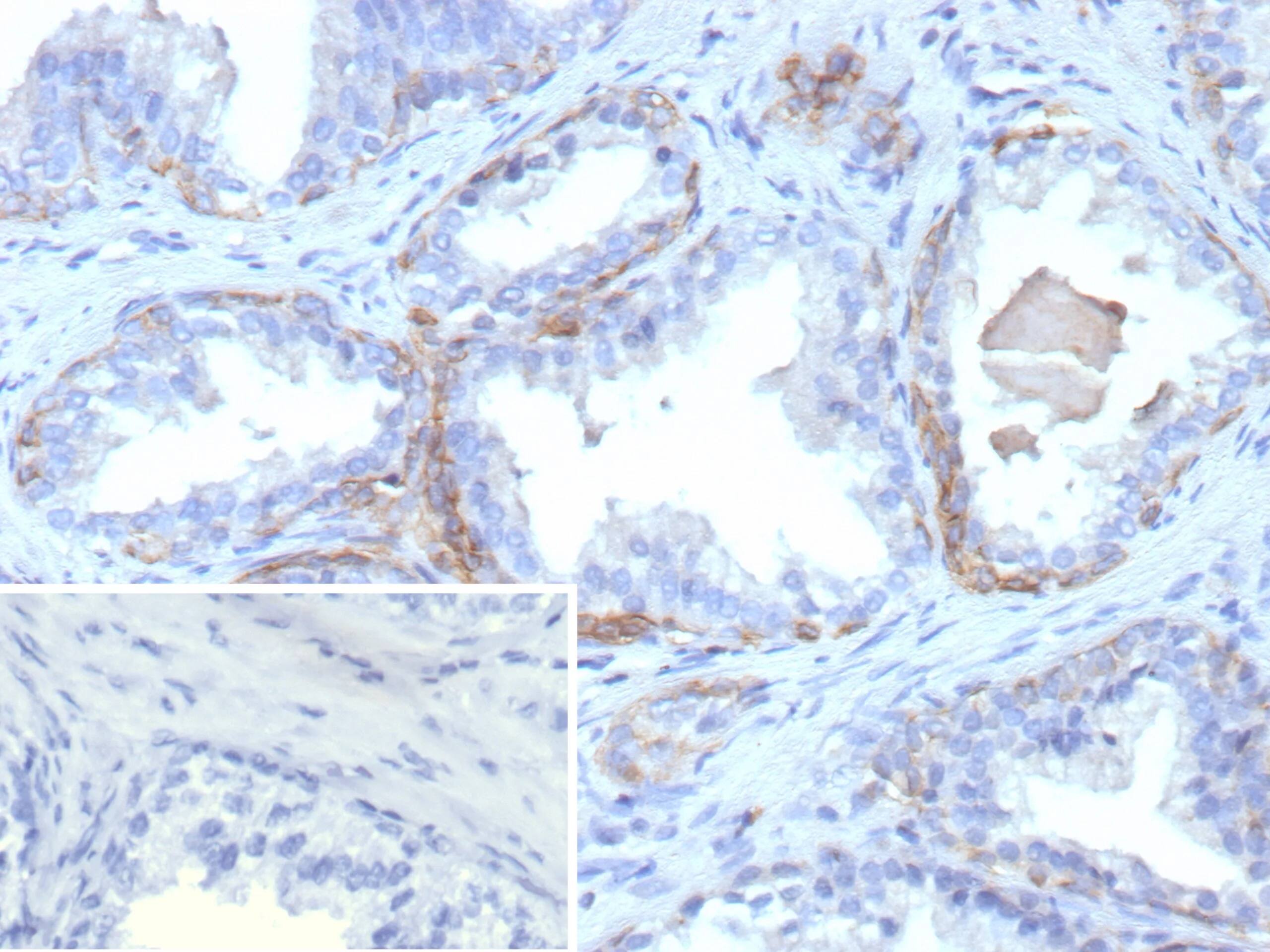 Cytokeratin 13 Antibody (rKRT13/9623)