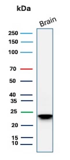MBP Antibody (rMBP/4288)