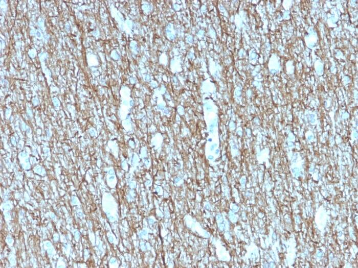 NF-H Antibody (rNF421)