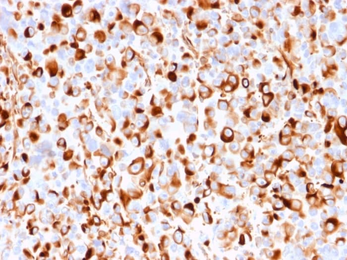 NGFR/TNFRSF16/p75NTR Antibody (rNGFR/1965)