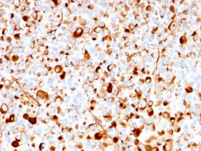 NGFR/TNFRSF16/p75NTR Antibody (rNGFR/1965)