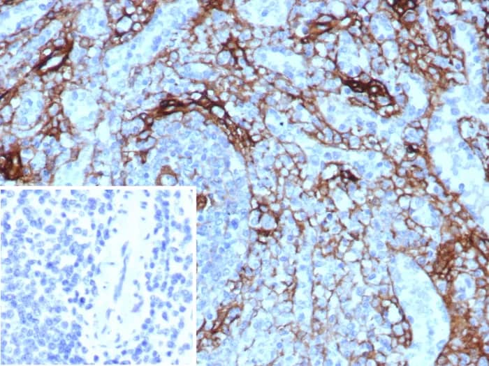 NGFR/TNFRSF16/p75NTR Antibody (NGFR/8590R)