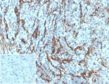 NGFR/TNFRSF16/p75NTR Antibody (NGFR/1997R)