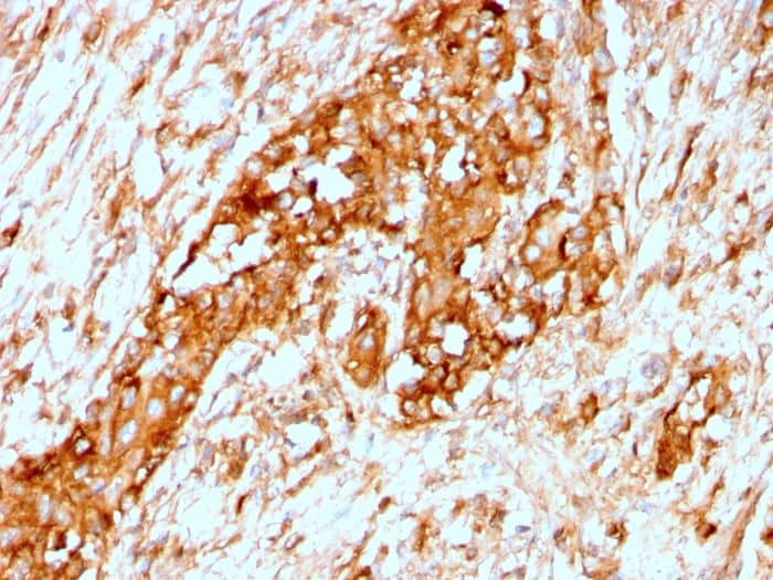 Serpin A1/alpha 1-Antitrypsin Antibody (AAT/3167R)