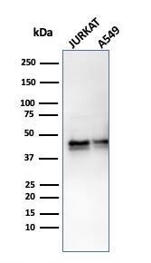 Serpin A1/alpha 1-Antitrypsin Antibody (AAT/3167R)