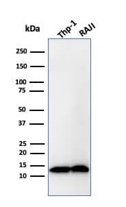 beta 2-Microglobulin Antibody (B2M/1857R)