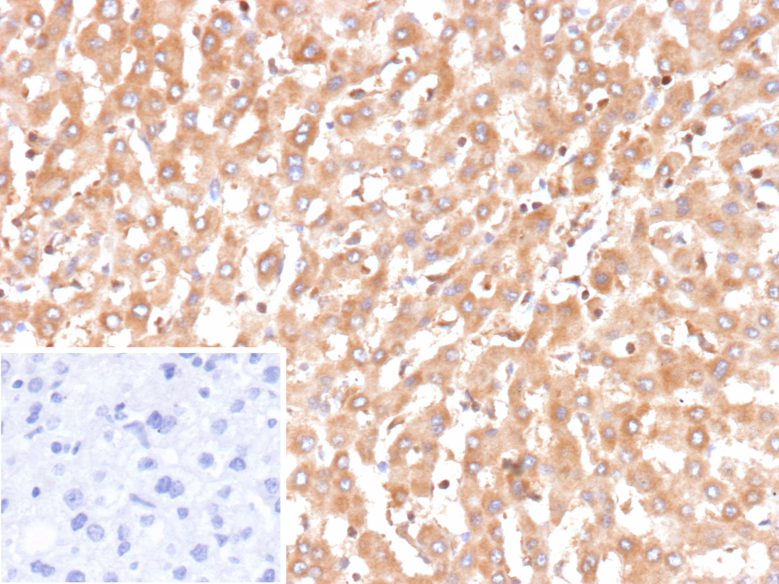 Bax Antibody (BAX/9925R)