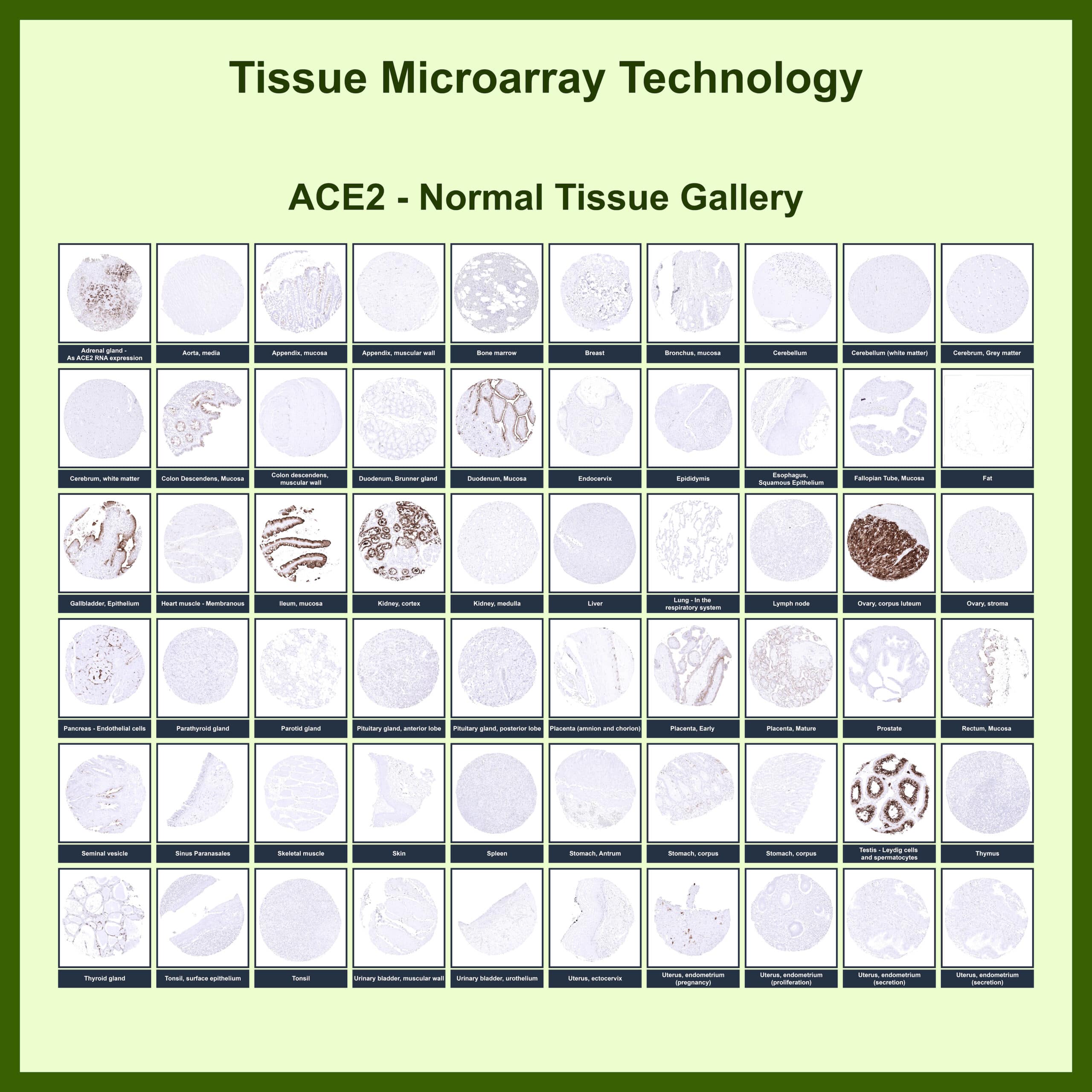 ACE-2 Antibody (ACE2/6788R)