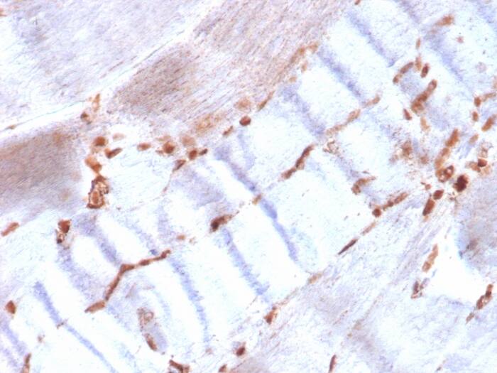 alpha-Smooth Muscle Actin Antibody (ACTA2/1614R)