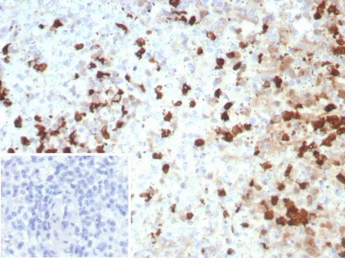 EN-RAGE/S100A12 Antibody (S100A12/8952R)